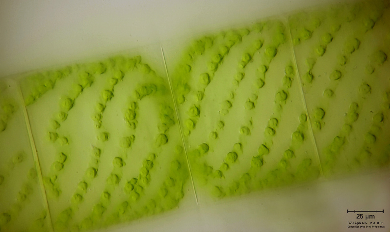 Spirogyra - zigospora